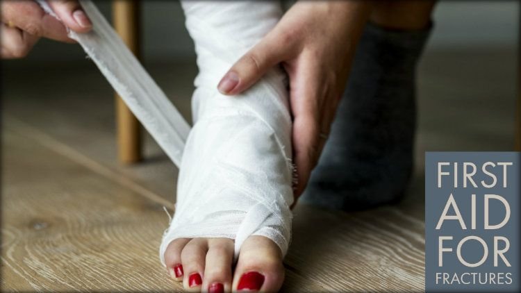 Post-Fracture And The Biggest Mistakes - Best Orthopedic Doctor in Kolkata