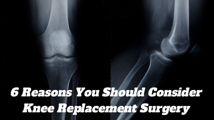 best-knee-surgeon-in-kolkata