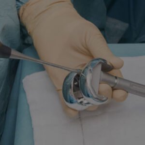 best knee replacement doctor in kolkata